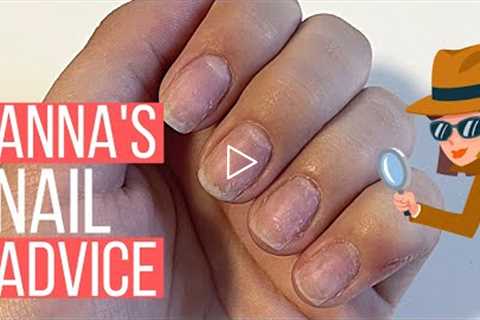 BREAKING, WEAK NAILS? HELP!!!  [ANNA'S NAIL ADVICE]