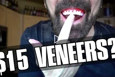 Perfect Smile Veneers Review: $15 Veneers?