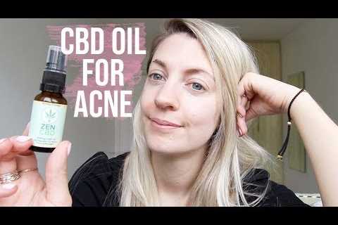 I TRIED CBD OIL FOR ACNE