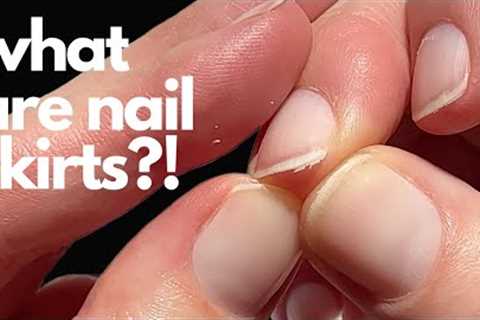 How to get rid of nail skirts.