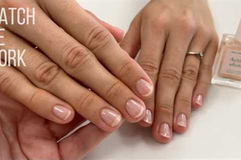 Problem nails with onycholysis  Gentle Manicure with Manucurist Active Shine